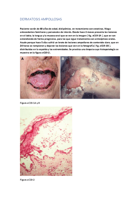 Miniatura del documento TEST DERMATOSIS AMPOLLOSAS.pdf