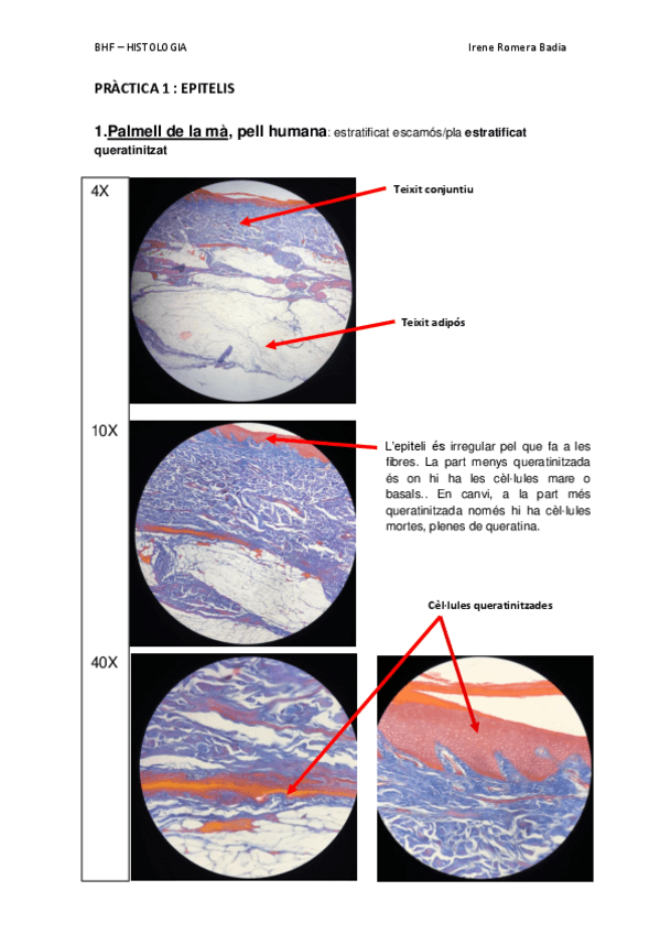 Miniatura del documento P1-EPITELIS.pdf
