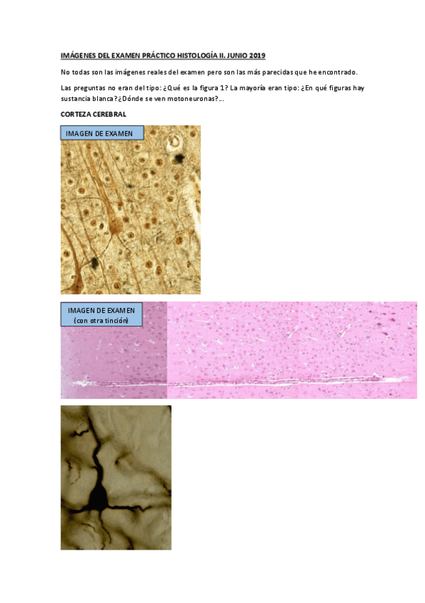 Miniatura del documento IMAGENES.-ExPRACTICO-HISTOLOGIA-II.-Junio-2019.pdf