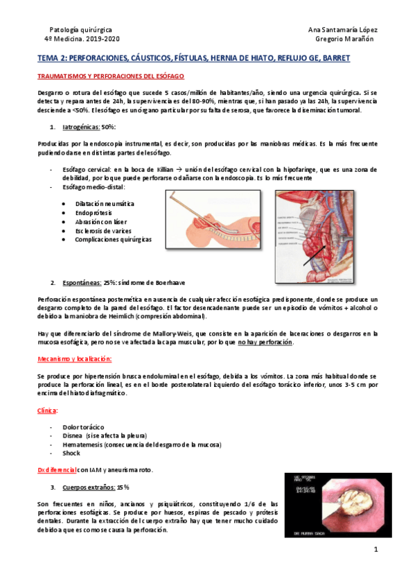 Miniatura del documento Tema-2-Perforaciones-causticos-fistulas-hernia-de-hiato-reflujo-GE-y-Barret.pdf