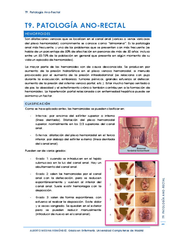 Miniatura del documento T9. Patología Ano-Rectal.pdf