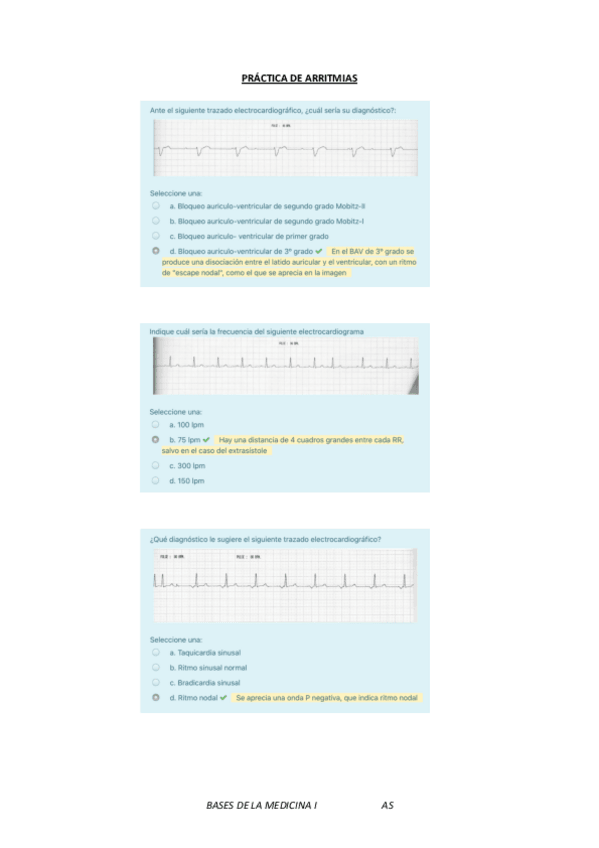 Miniatura del documento Practica-de-arritmias.pdf