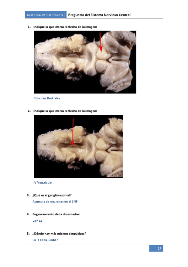 Miniatura del documento Preguntes-SNC.pdf