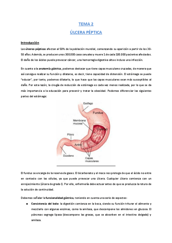 Miniatura del documento Tema-2-Ulceras-Pepticas.pdf