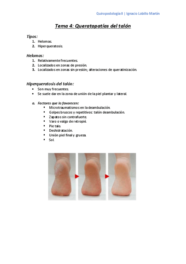 Miniatura del documento Tema-4.pdf