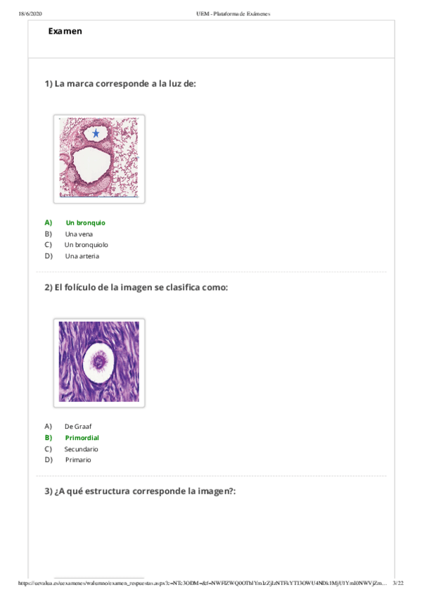 Miniatura del documento EXAMEN-PRACTICAS-HISTOLOGIA-2020.pdf