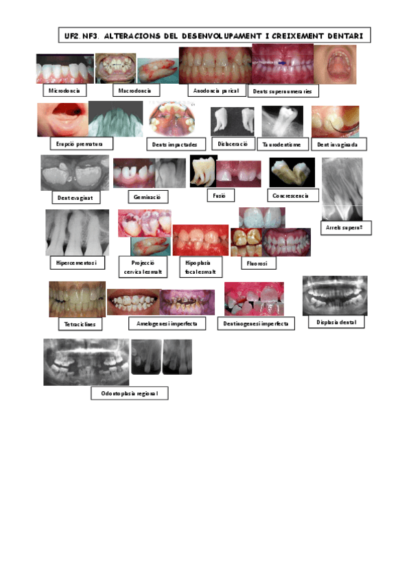Miniatura del documento UF2-NF3-ALTERACIONS-DESENVOLUPAMENT-I-CREIXEMENT-DENTARI-FOTOS.pdf