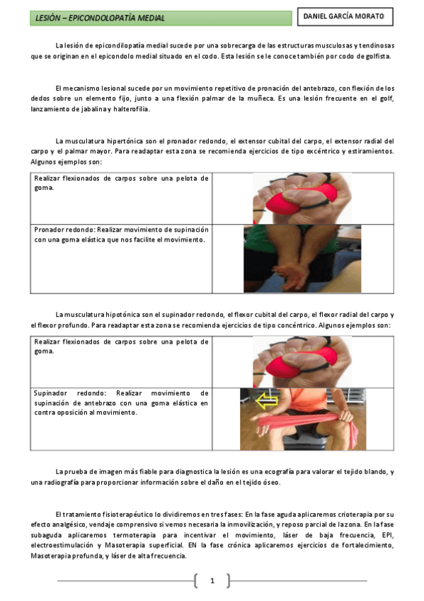 Miniatura del documento Lesión - Epicondilopatía medial.pdf