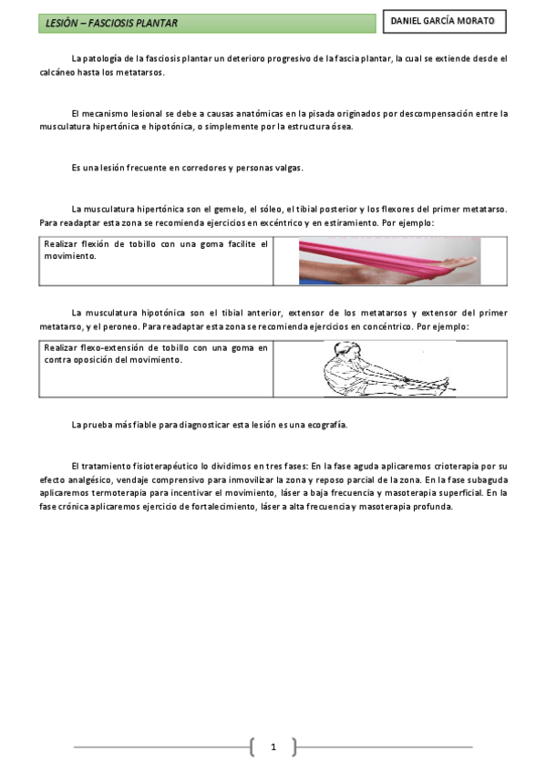 Miniatura del documento Lesión - Fasciosis plantar.pdf