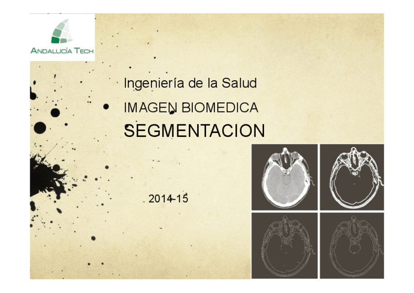 Miniatura del documento Tema 6. Filtros Y Segmentación.pdf