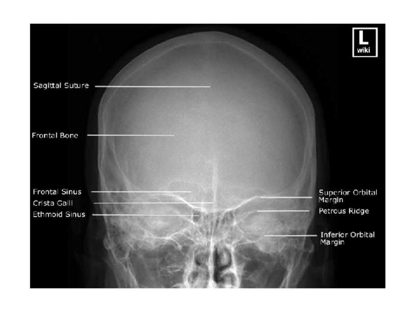 Miniatura del documento imatges-crani-2010.ppt