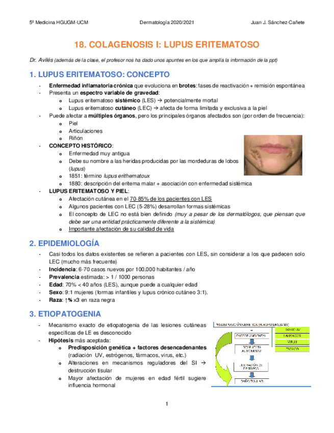 Miniatura del documento 18-COLAGENOSIS-I-LUPUS-ERITEMATOSO.pdf