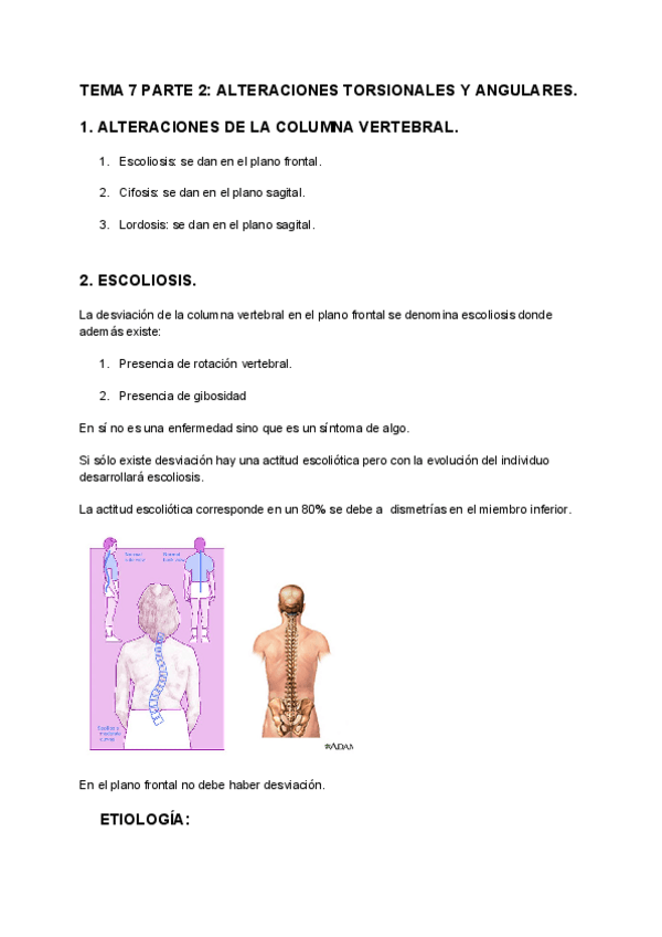 Miniatura del documento TEMA-7-PARTE-2-ALTERACIONES-TORSIONALES-Y-ANGULARES.pdf