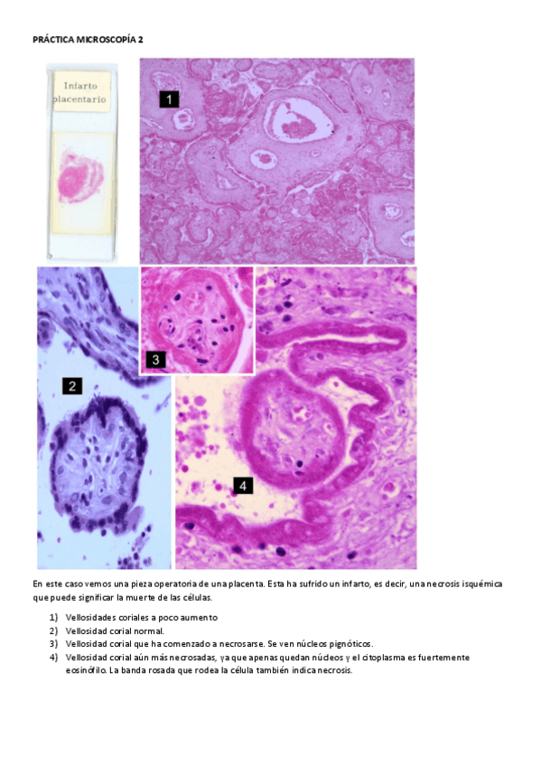 Miniatura del documento PRACTICA-MICROSCOPIA-2-RESUELTA.pdf
