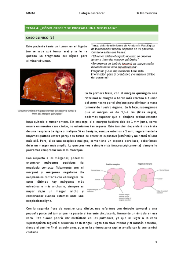 Miniatura del documento TEMA-4-Como-crece-y-se-propaga-una-neoplasia.pdf