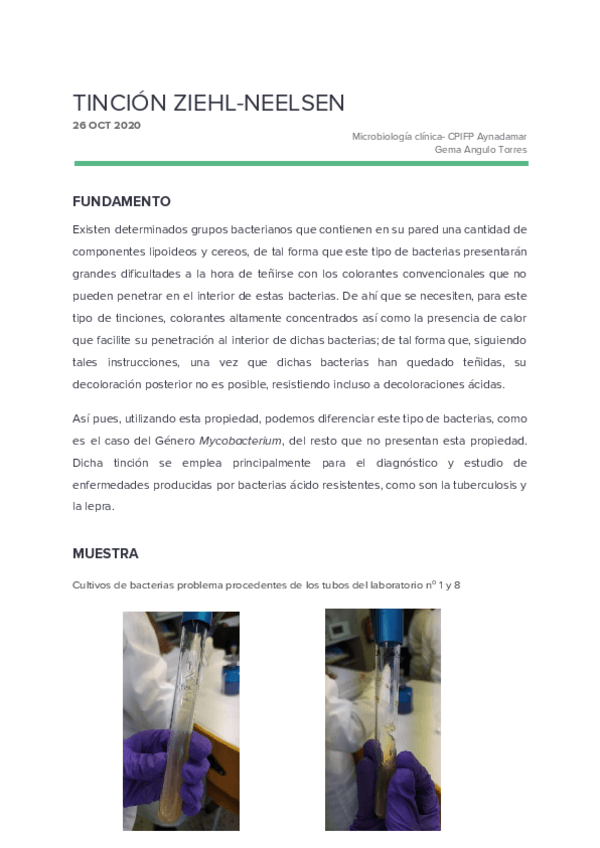 Miniatura del documento 4 tinción de ziehl-neelsen