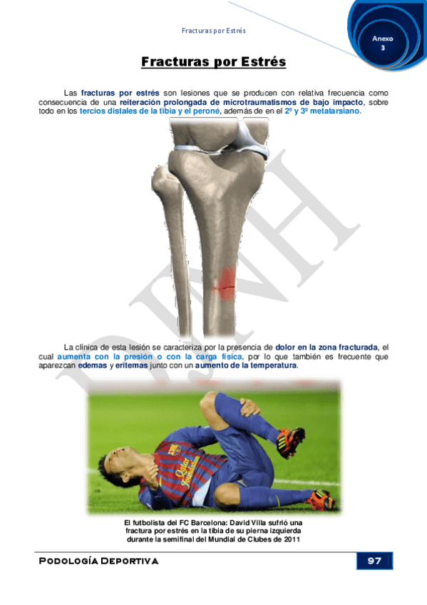 Miniatura del documento Anexo-3Fracturas-por-Estres.pdf