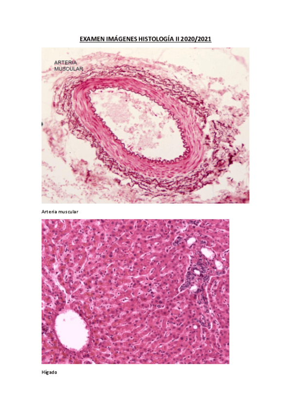 Miniatura del documento EXAMEN-IMAGENES-HISTOLOGIA-II-2020.pdf