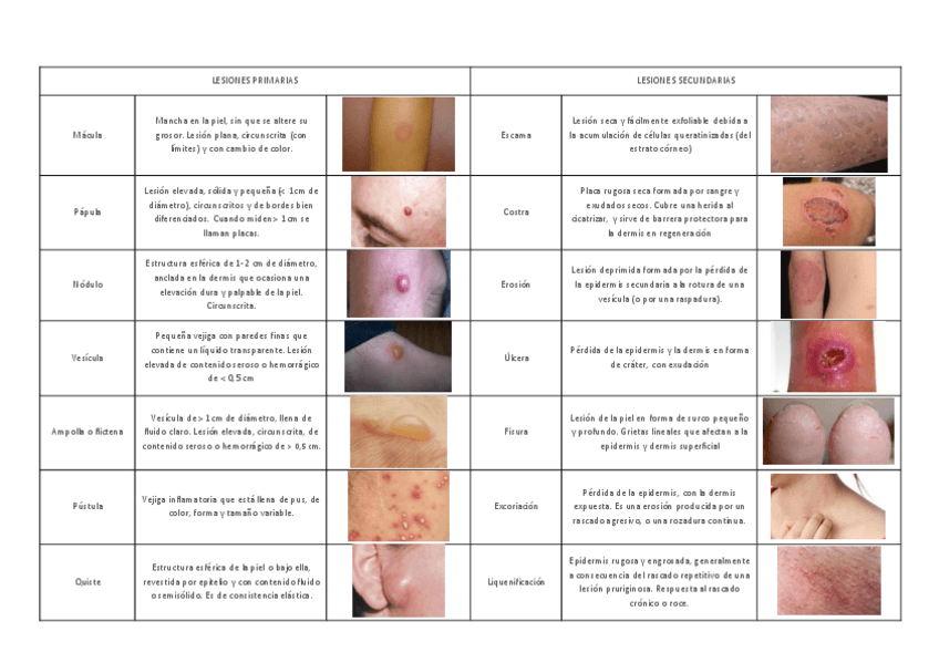 Miniatura del documento LESIONES-PRIMARIAS.pdf