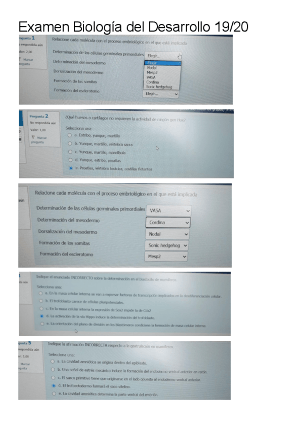 Miniatura del documento Examen-Biologia-del-Desarrollo-19-20.pdf