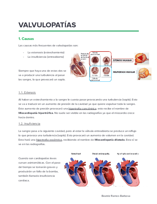 Miniatura del documento Valvulopatias-practica.pdf