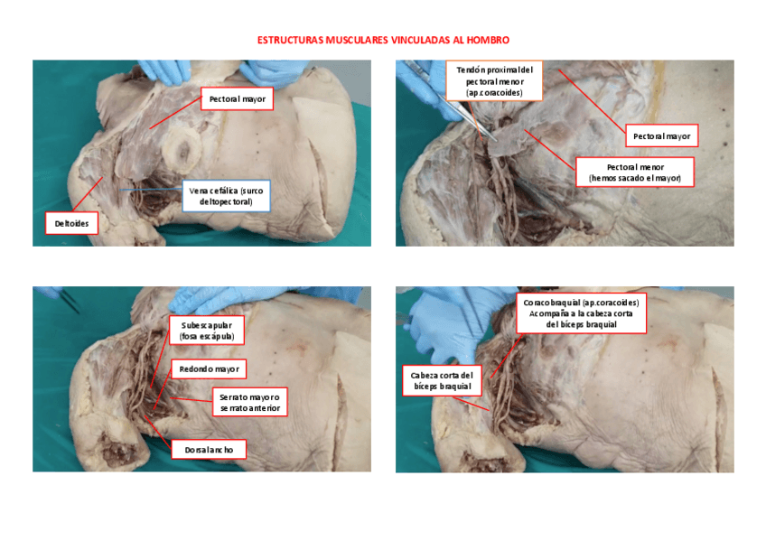 Miniatura del documento Miembro-superior.pdf