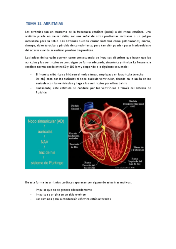 Miniatura del documento Arritmias.pdf