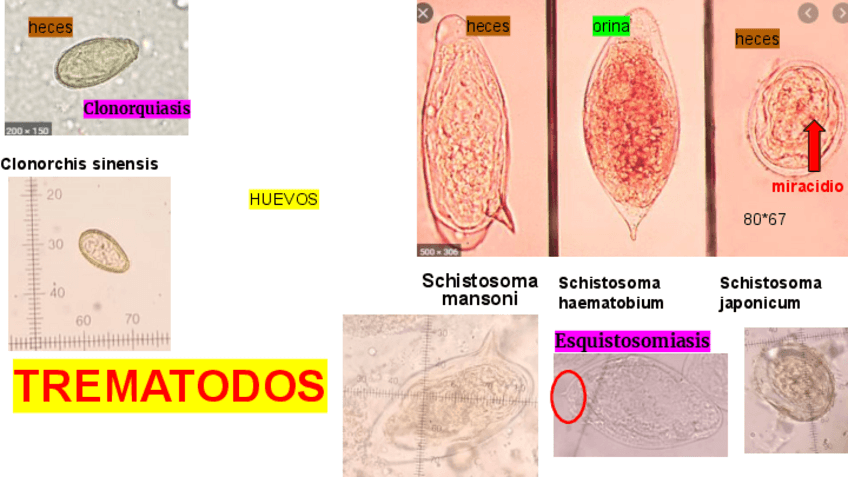 Miniatura del documento Resumen-practicas-parasitologia-clinica.pdf