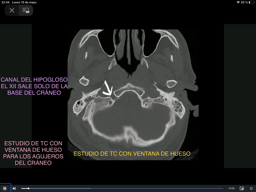 Miniatura del documento PRACTICA-RAYOS-SNC-1-.pdf