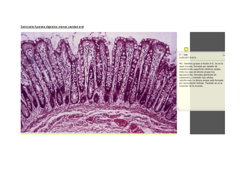 Miniatura del documento Seminario Aparato digestivo excepto la cavidad oral.pdf