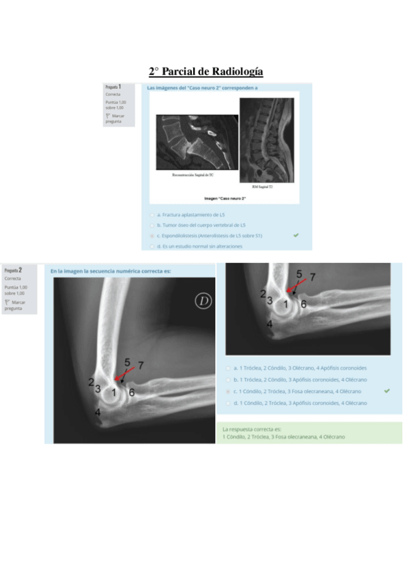 Miniatura del documento 2o-Parcial-Radiologia.pdf