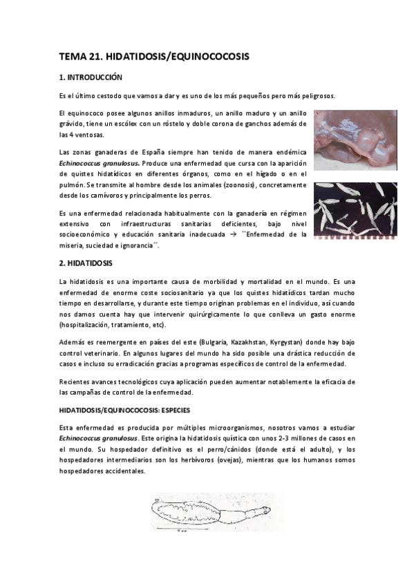 Miniatura del documento TEMA-21-Hidatidosis.pdf