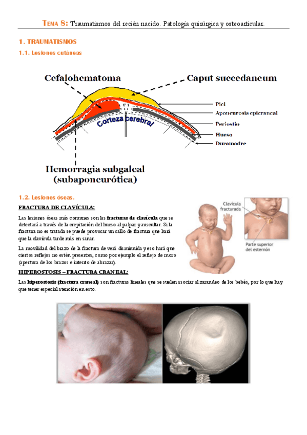Miniatura del documento TEMA-8-Traumatismos-del-recien-nacido.pdf