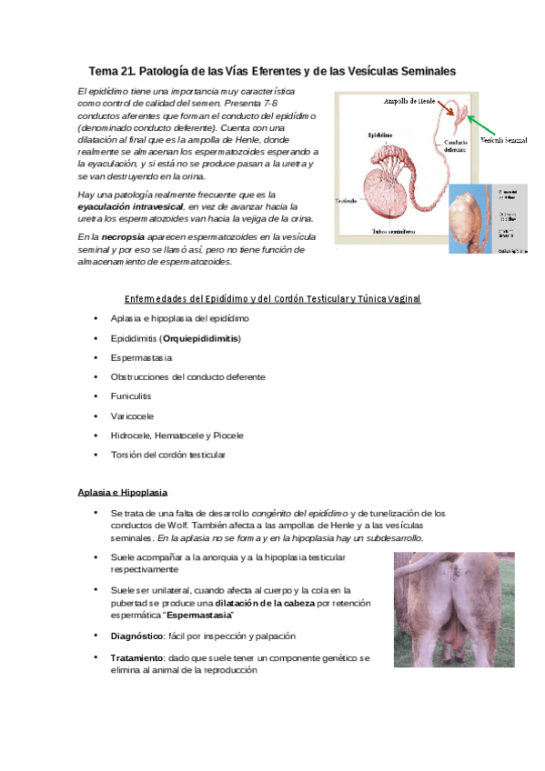 Miniatura del documento Tema-21-Patologia-de-las-Vias-Eferentes-y-Vesiculas-Seminales.pdf