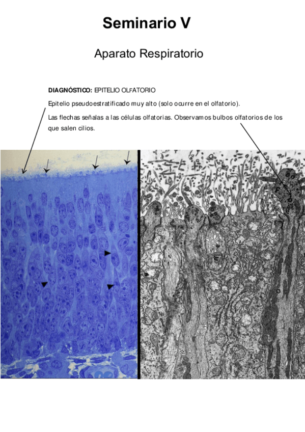 Miniatura del documento Seminario-2-Aparato-Respiratorio.pdf