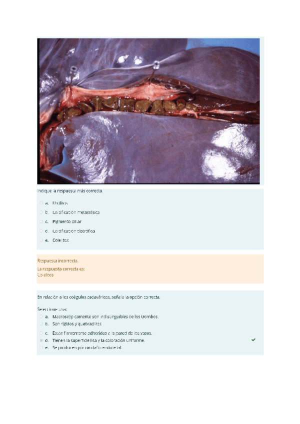 Miniatura del documento APG-EXAMEN CORREGIDO.pdf