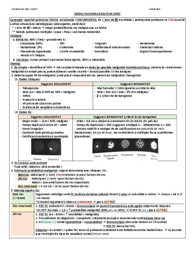 Miniatura del documento NODUL-PULMONAR-SOLITARI.pdf