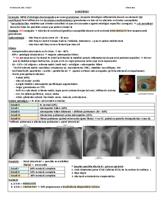 Miniatura del documento SARCOIDOSI.pdf