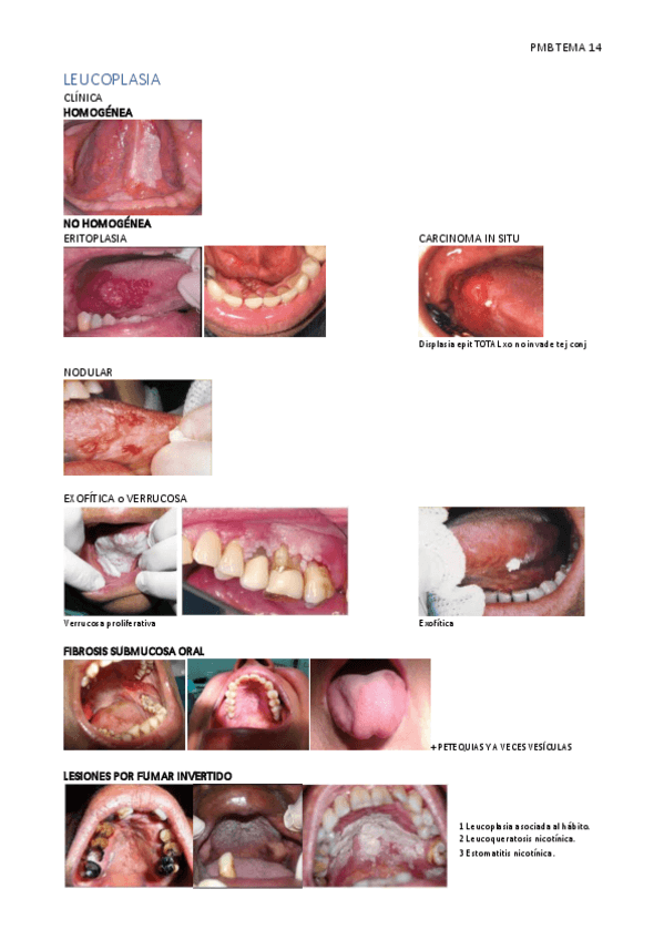 Miniatura del documento PMB-TEMA-14.pdf