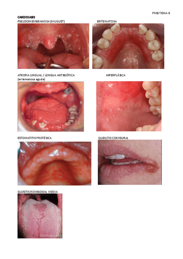 Miniatura del documento PMB-tema-8.pdf