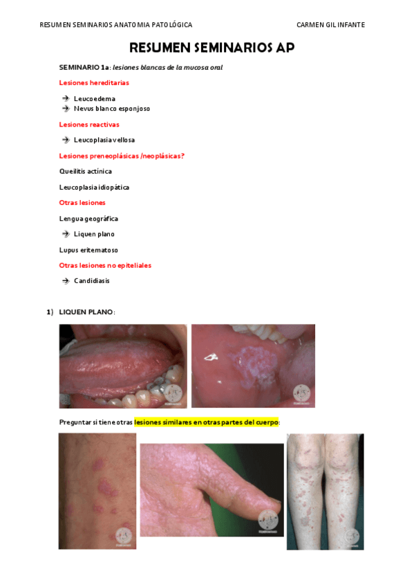 Miniatura del documento RESUMEN-SEMINARIOS-Anatomia-Patologica.pdf