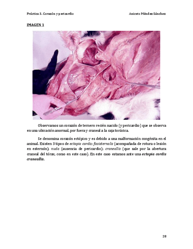 Miniatura del documento Práctica 3. Corazón y pericardio COMPLETA.pdf