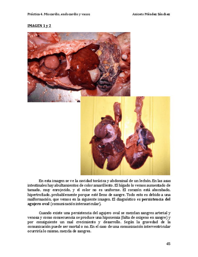 Miniatura del documento Práctica 4. Miocardio endocardio y vasos COMPLETA.pdf