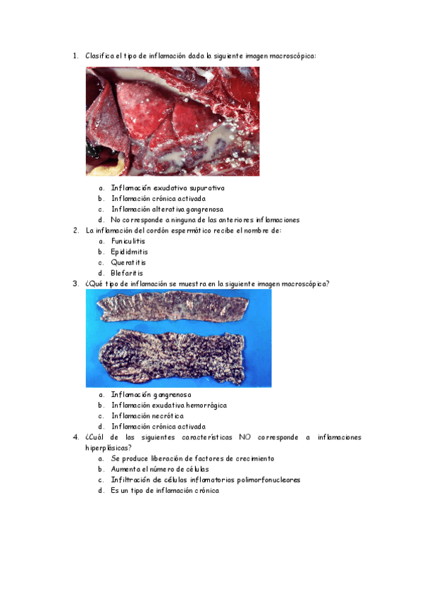 Miniatura del documento APG-Test-inflamaciones-1.pdf