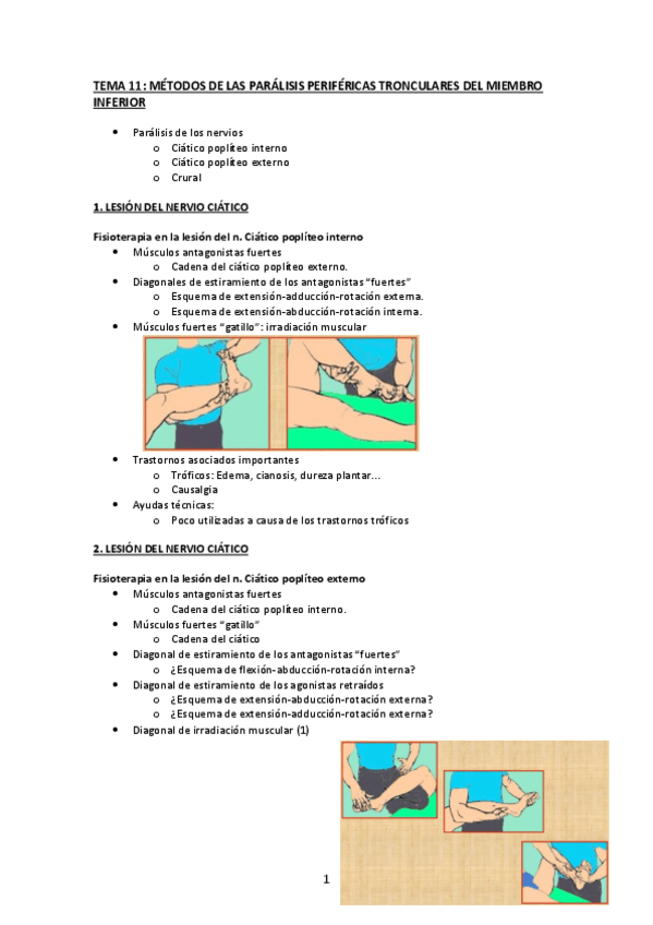 Miniatura del documento TEma 11. Paralisis perifericas tronculares MI.pdf