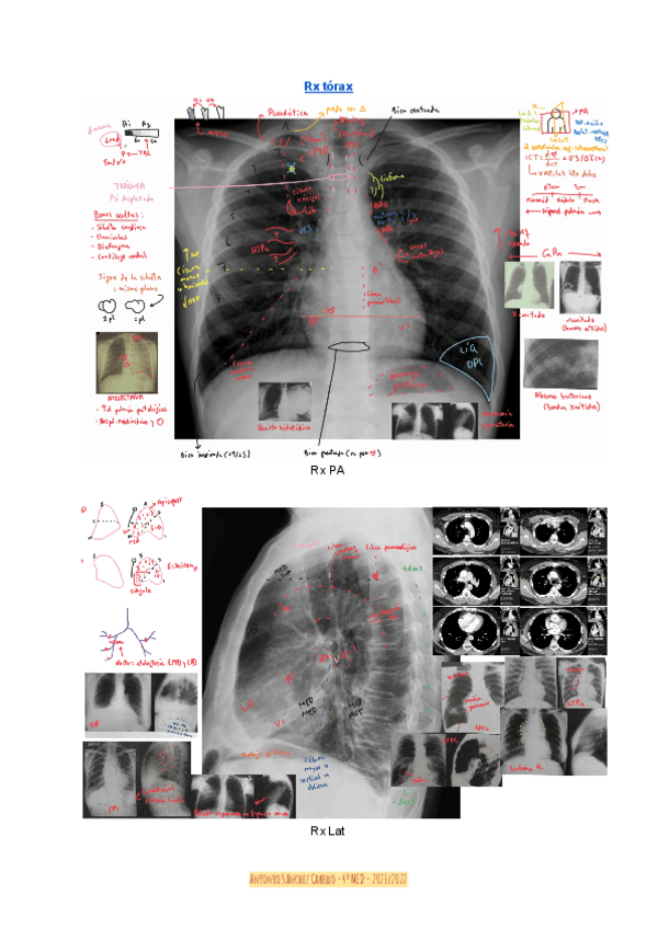 Miniatura del documento Resumen-Rx-torax.pdf