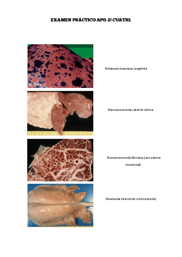 Miniatura del documento EXAMEN-PRACTICO-APG-2o-CUATRI.pdf