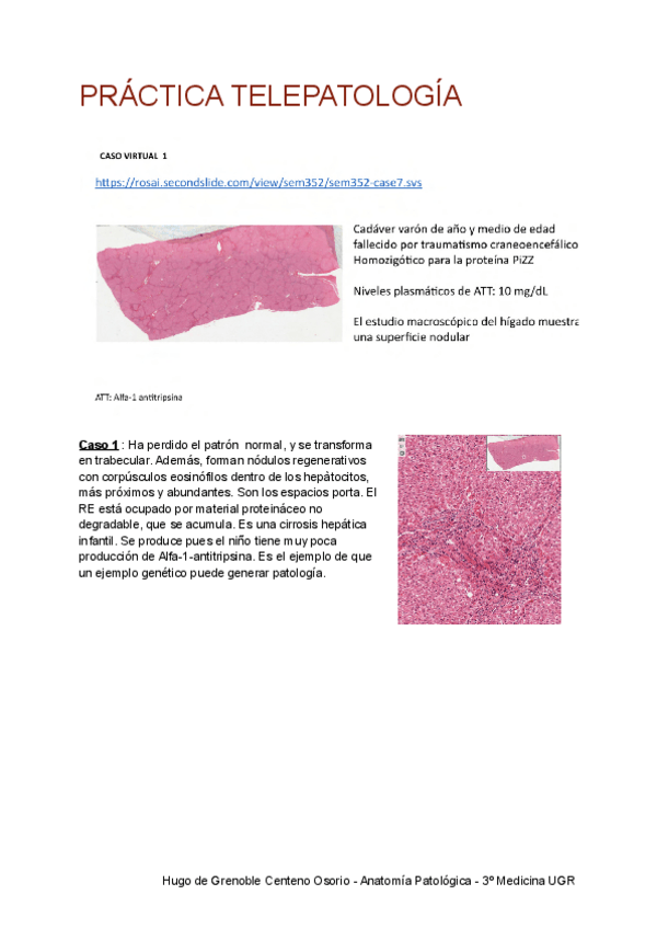 Miniatura del documento Practica-Telepatologia-comprimido.pdf