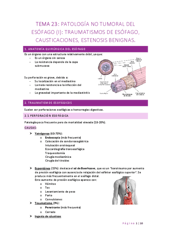 Miniatura del documento TEMA-23-TX-ESOFAGICOS-CAUSTICACIONES-Y-ESTENOSIS-BENIGNAS.pdf