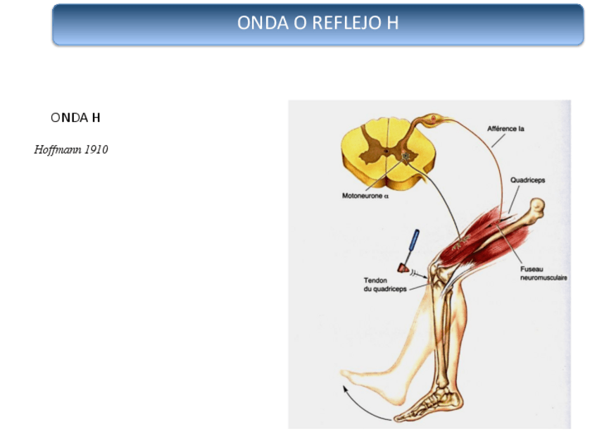 Miniatura del documento REFLEJO-H.pdf
